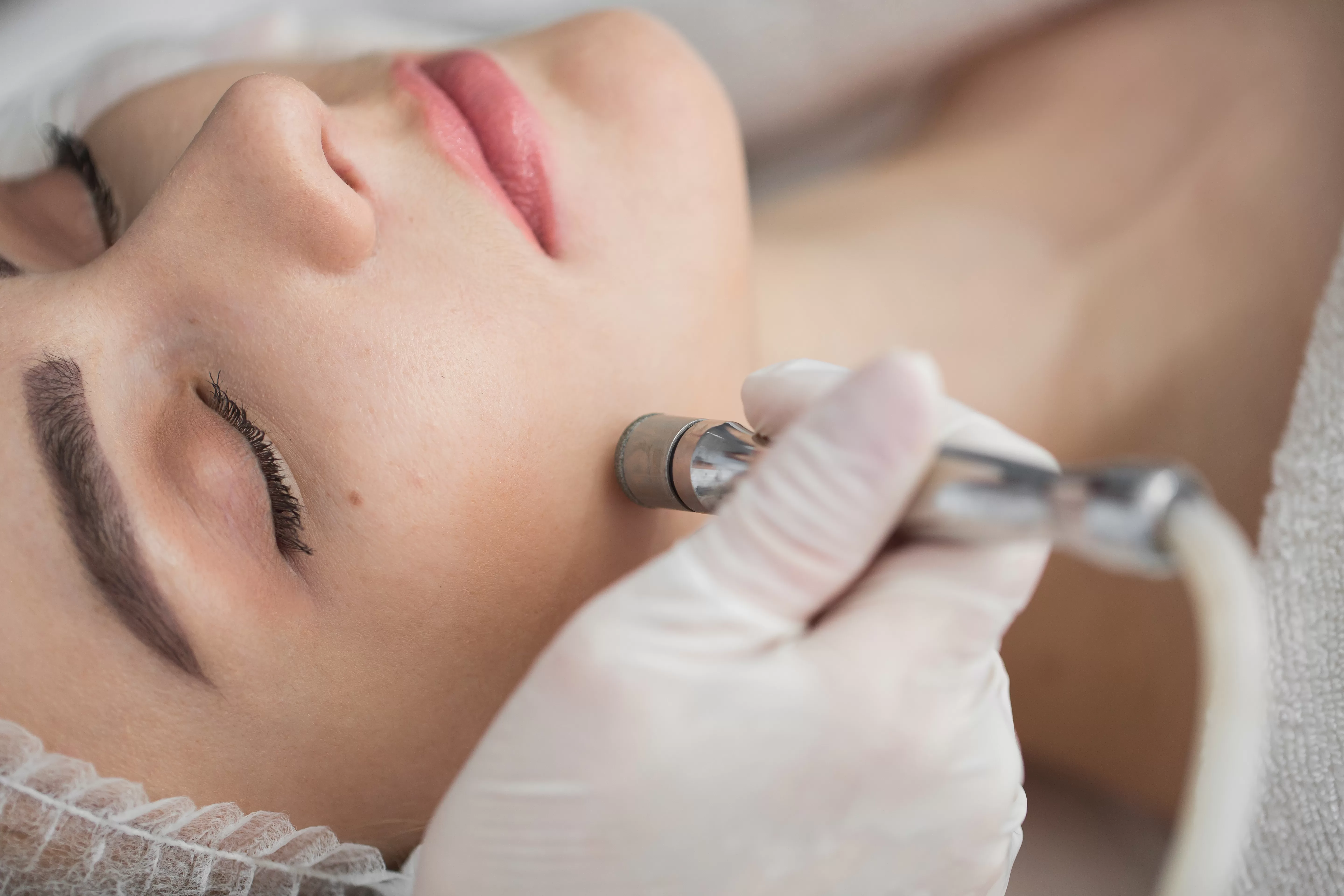 Diamond microdermabrasion, peeling cosmetic. woman during a microdermabrasion treatment in beauty